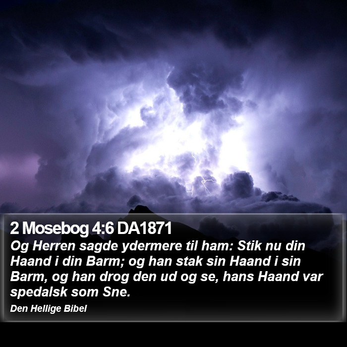 2 Mosebog 4:6 DA1871 Bible Study